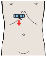 Medial and anterior hepatic segments, left portal vein branch, caudate lobe