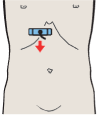 Medial and anterior hepatic segments, left portal vein branch, caudate lobe