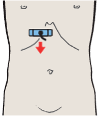 Medial and anterior hepatic segments, quadrate lobe, ligamentum teres, portal vein