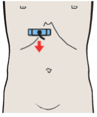 Medial and anterior hepatic segments, quadrate lobe, ligamentum teres, gallbladder