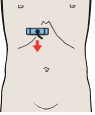 Medial and anterior hepatic segments, quadrate lobe, ligamentum teres, gallbladder