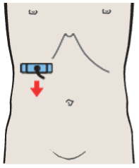 Posterior segment, portal vein