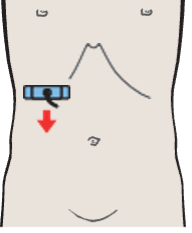 Posterior segment, caudal subsegment, kidney