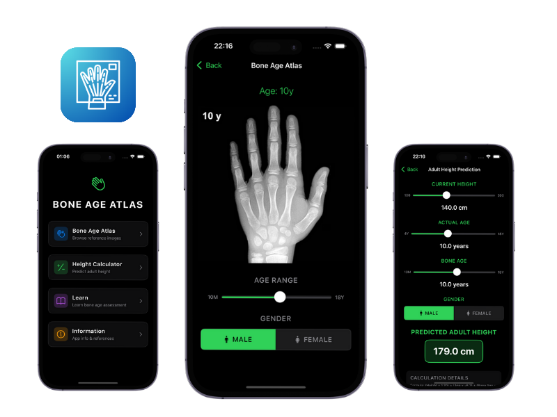 Try Easy Bone Age Atlas Mobile App screenshot