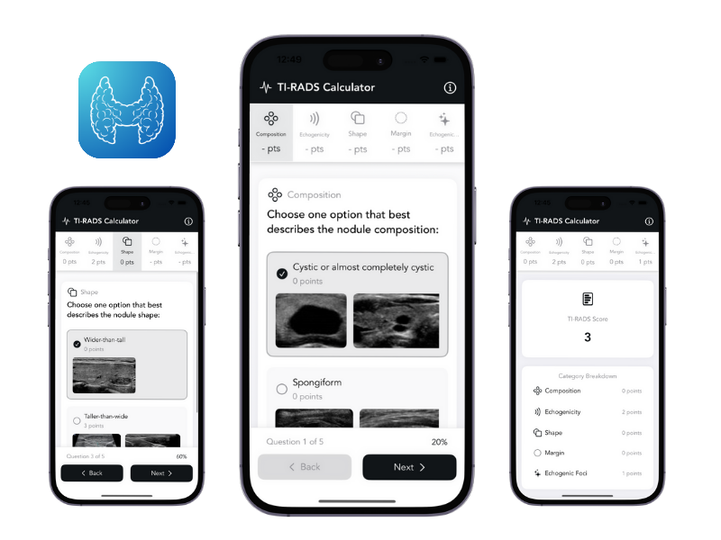 Try Easy TI-RADS Calculator Mobile App screenshot