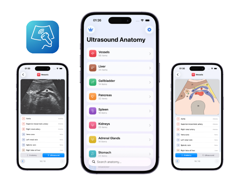 Try Ultrasound Anatomy Mobile App screenshot