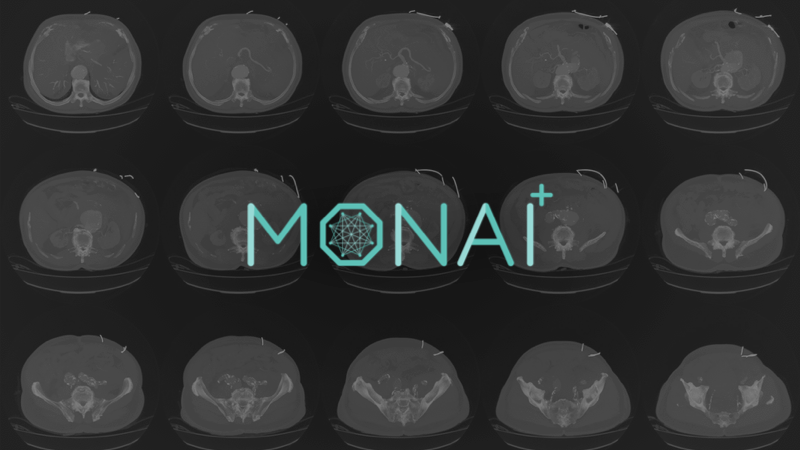 Getting Started AI in Healthcare with MONAI